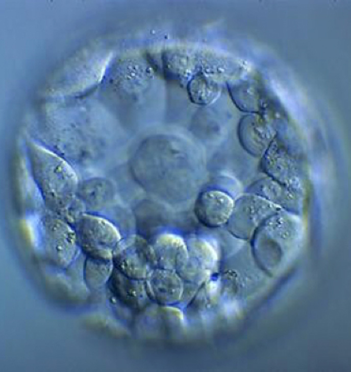 embrion